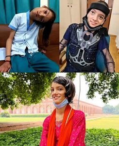 For 12 Years, She Saw the World SidewaysThen a Remarkable Surgery Changed Her Life - photo 231