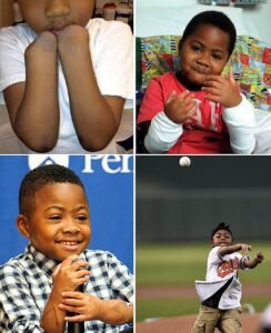 At Just 8 Years Old, Zion Harvey Made Medical History With a Double Hand Transplant - photo 206