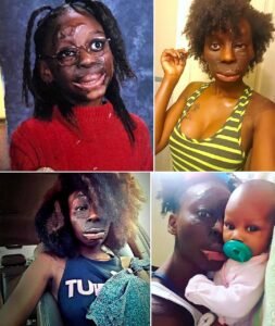 At just two years old, Alyssa McDonald survived an accident so devastating that doctors warned her family to p - photo 137