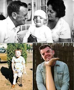 His Mother Couldnt Look at Him for a Week. Years Later, He Chose to Keep the Face Everyone Else Noticed. - photo 149