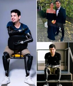 At just 18 years old, Pedro Pimenta woke up from a coma and discovered that his life had changed forever - photo 131