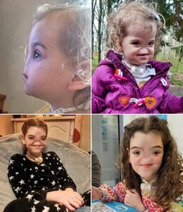 Tessa Evans The Girl Who Was Born Without a Nose but Never Without a Smile - photo 210