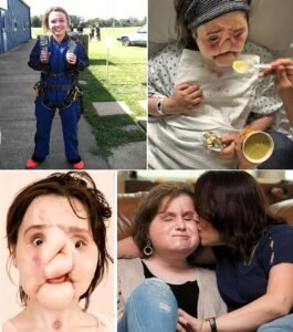 At just 18 years old, Katie Stubblefields life changed in a single devastating moment - photo 124