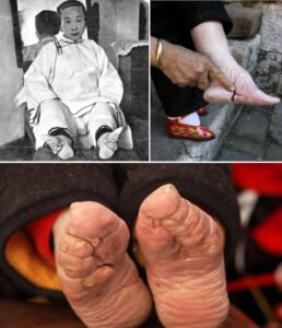 For centuries, a womans beauty in parts of China could be judged by something she had no control over at birth - photo 186