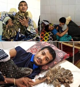 Abul Bajandar The Father Who Just Wanted to Hold His Daughter Again - photo 183