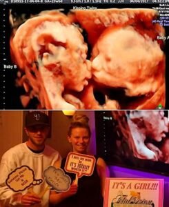 Before They Were Born, These Twin Sisters Shared a Moment Their Parents Would Never Forget - photo 164