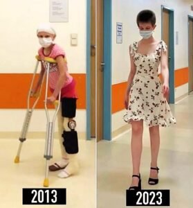 Ten Years After Cancer Took Away Her Walk, Aly Returned to the Same Hospital in High Heels - photo 156