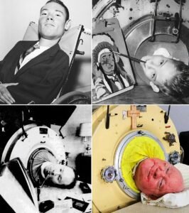 At just 6 years old, Paul Alexander entered an iron lung - photo 115