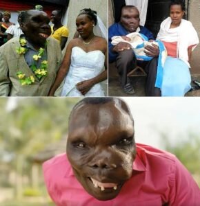 They Stared at His Face for Years  Then Godfrey Baguma Made the World Listen to His Voice - photo 103
