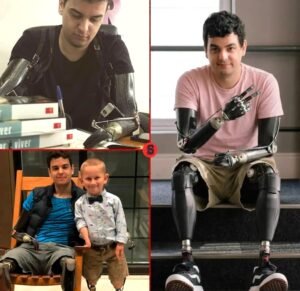 He Lost All Four Limbs at 18  Then Turned His Pain Into a Mission to Help Others - photo 105