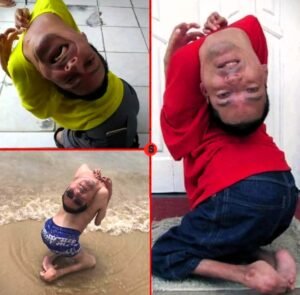 From the very beginning of his life, doctors faced a difficult reality his body had developed in ways that mad - photo 70
