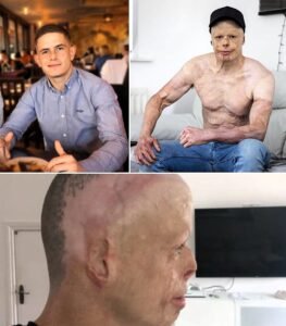 11,000 volts changed his life forever, but Darren refused to give up - photo 74