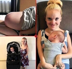 She Was Told She Might Not Live Past One Then She Became a Mother - photo 72