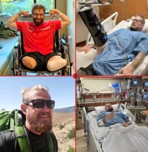 A Small Campfire Burn Cost Him Both Legs, but Max Armstrong Refuses to Give Up on His Mountain Dreams - photo 46