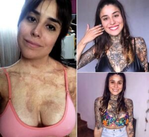 Lali Jurez Turned Her Burn Scars Into Beautiful Art and Found the Confidence to Show Her Skin Again - photo 28