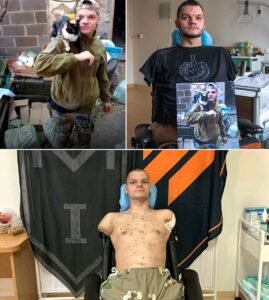 he lost all four limbs in the war, but refused to let life silence his voice - photo 3